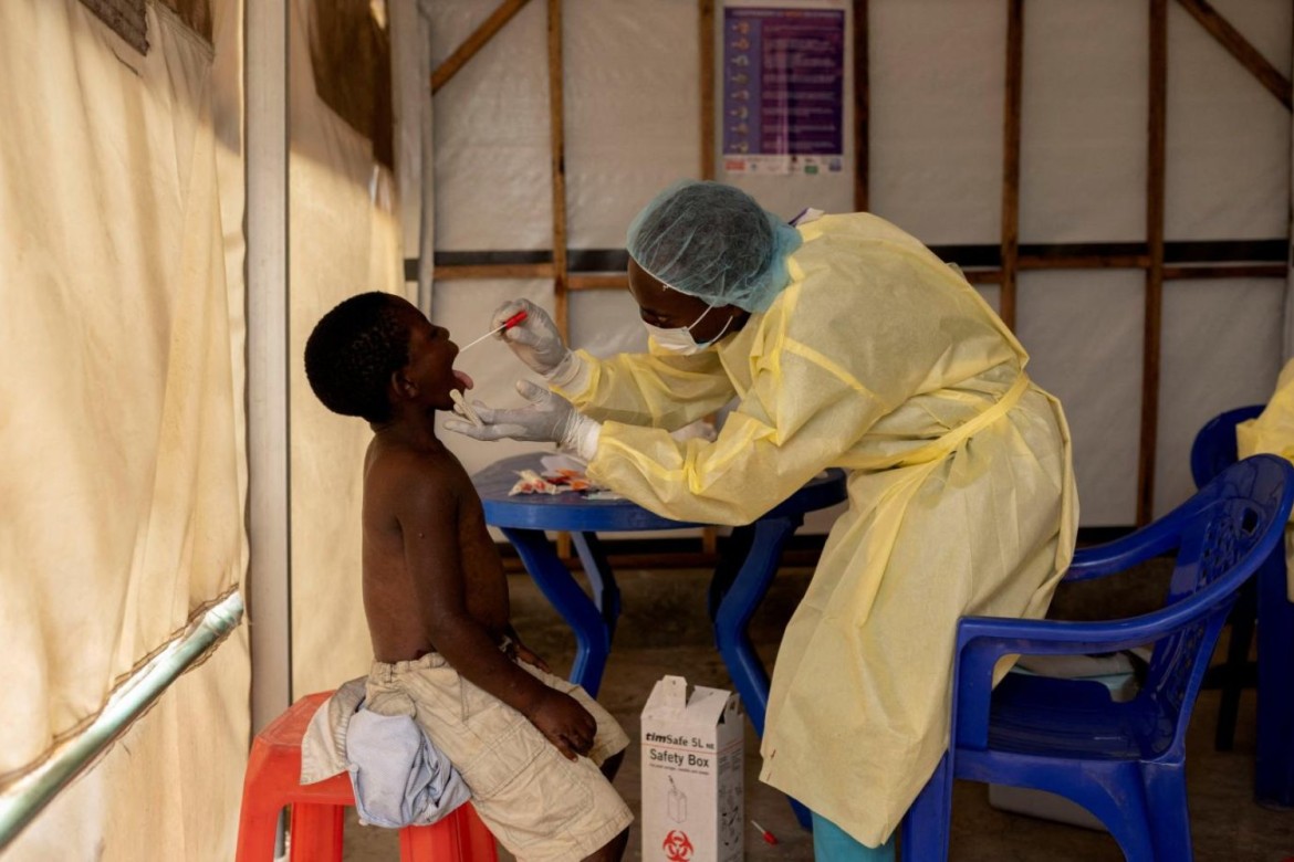 Dörd sualda meymunçiçəyi epidemiyası – Ən təhlükəli variant