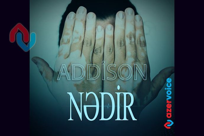 Addison xəstəliyi nədir?