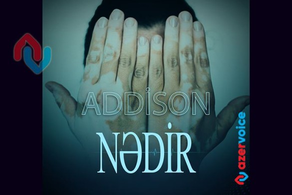 Addison xəstəliyi nədir?