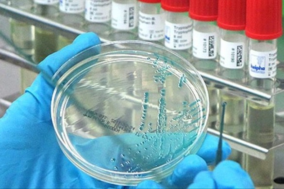 İngiltərədə H5N1 quş qripi aşkarlanıb