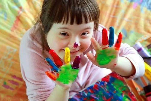 Bu gün Dünya Daun Sindromu günüdür