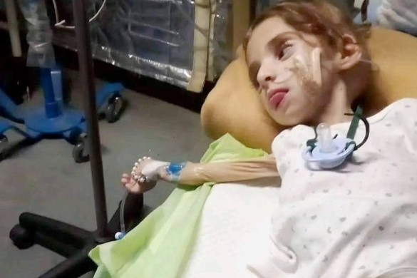 Qəzzada 3500 uşaq aclıqdan ölmək təhlükəsi ilə üz-üzədir