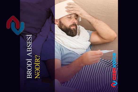 Brodi absesi nədir? Sümük daxilində xroniki infeksiyanın atipik forması