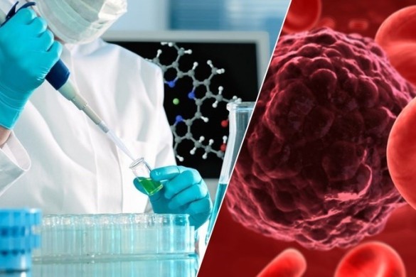 Xərçəng xəstəliyi üçün yeni müalicə metodu aşkar olunub